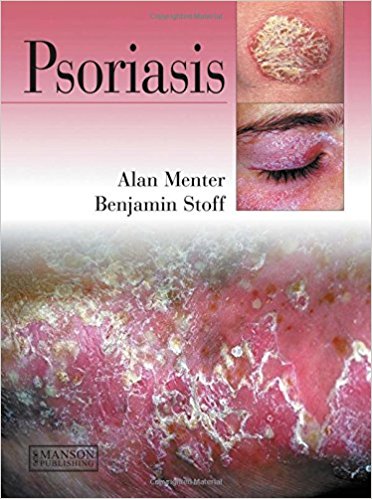 libros psoriasis